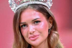 Хирург заподозрила новую «Мисс Россия» в пластике лица